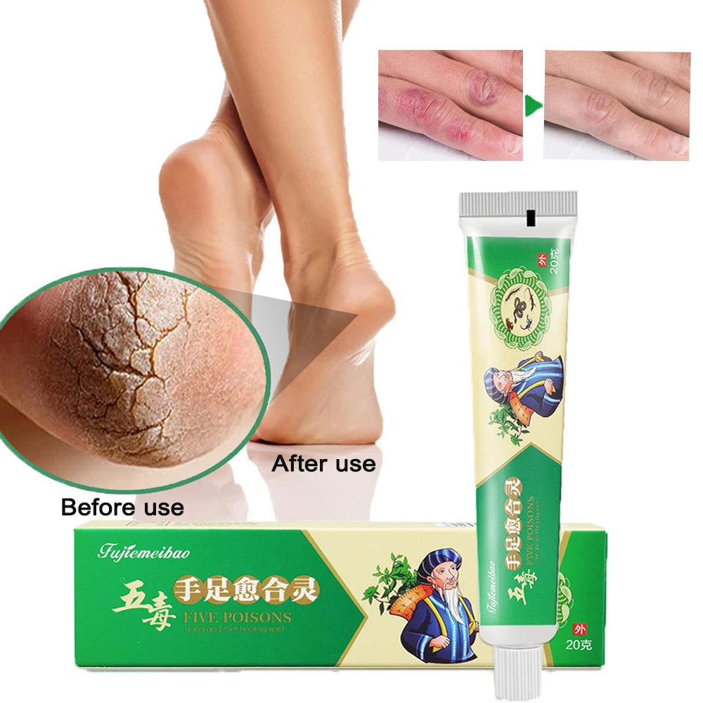 Anti Crack Cream